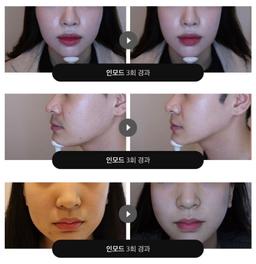 오가나셀 피부과의원 청담본점